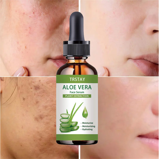 Siero Viso all'Aloe Vera TRSTAY – Anti-Età, Idratante e Nutriente per Pelle Luminosa e Giovane (5ml / 15ml / 30ml / 50ml)
