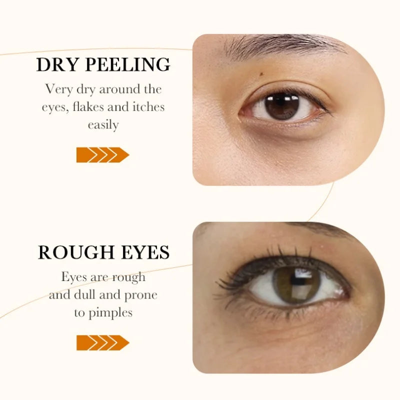 BIOAQUA Rice Raw Pulp Eye Mask - 60 Patches for Dark Circles & Puffiness