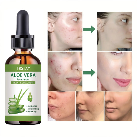 Siero Viso all'Aloe Vera TRSTAY – Anti-Età, Idratante e Nutriente per Pelle Luminosa e Giovane (5ml / 15ml / 30ml / 50ml)